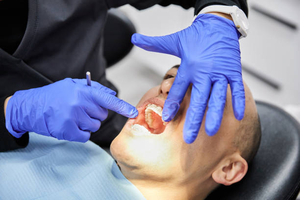 Best Emergency Care for Gum Disease in Severance, CO