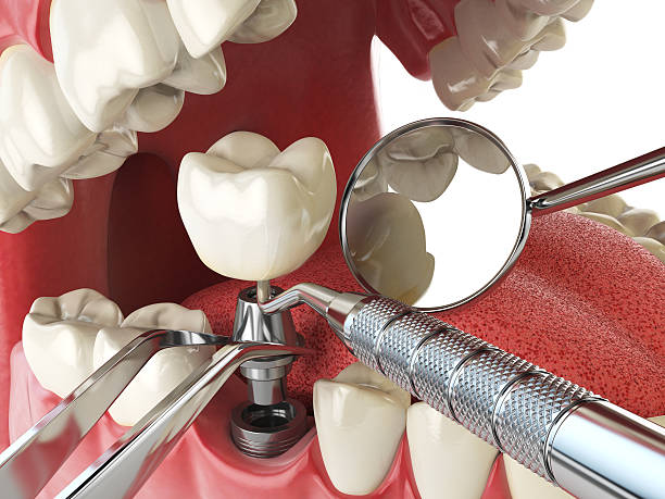 Best Emergency Treatment for Oral Infections in Severance, CO