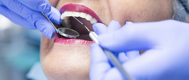 Best Emergency Root Canal Therapy in Severance, CO